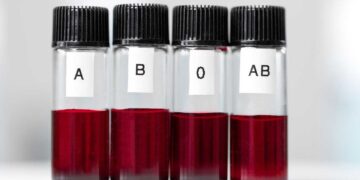 Uzmanlar Açıkladı: Zekası Daha Yüksek Kan Grupları