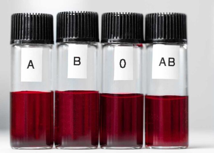 Uzmanlar Açıkladı: Zekası Daha Yüksek Kan Grupları